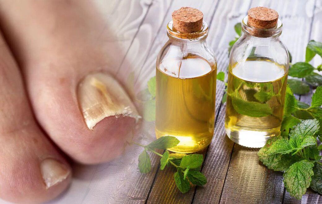 Vinaigre contre la mycose des ongles