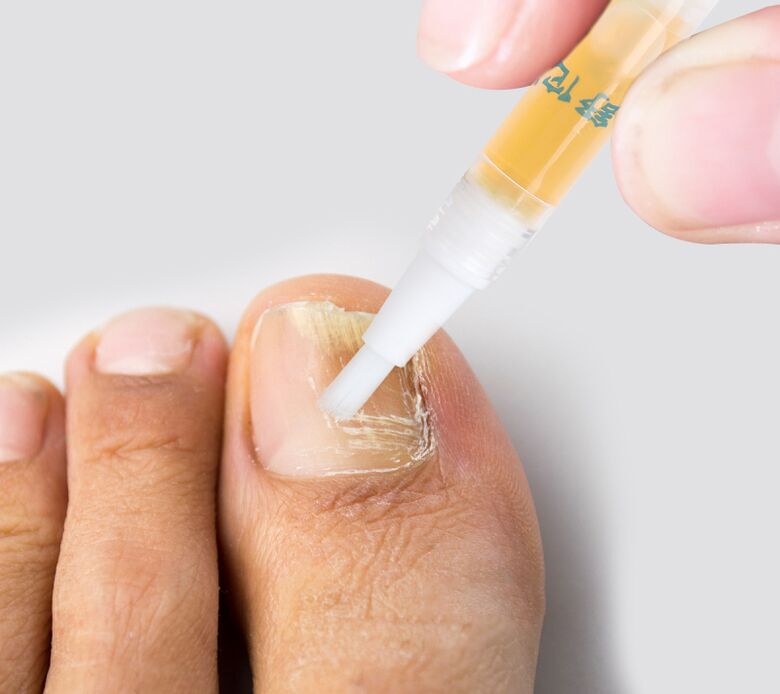 Liquide pour mycose des ongles des pieds